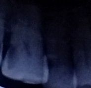 一般人も歯が大事